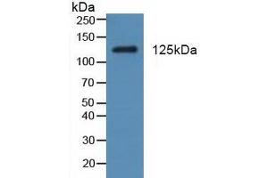Western blot analysis of Rat Testis Tissue. (PDGFRA antibody  (AA 170-387))