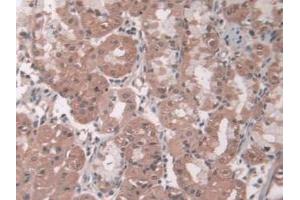 Figure. (Pepsin antibody)