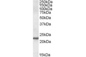 Image no. 1 for anti-SAR1 Homolog A (SAR1A) (Internal Region) antibody (ABIN375021) (SAR1A antibody  (Internal Region))