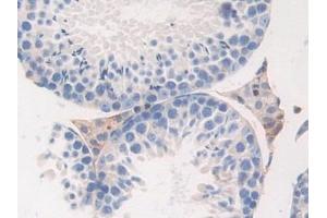 Immunohistochemistry (IHC) image for anti-Fibrinogen beta Chain (FGB) (AA 35-481) antibody (ABIN7433273)
