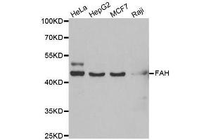 Western blot analysis of extracts of various cell lines, using FAH antibody. (FAH antibody  (AA 1-419))