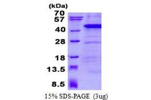 Ankyrin Repeat Domain 1 (Cardiac Muscle) (ANKRD1) (AA 1-319) protein (His tag)