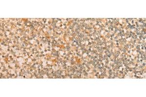 Immunohistochemistry of paraffin-embedded Human tonsil tissue using CFHR2 Polyclonal Antibody at dilution of 1:35(x200) (CFHR2 antibody)