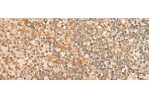 Immunohistochemistry of paraffin-embedded Human tonsil tissue using CFHR2 Polyclonal Antibody at dilution of 1:35(x200) (CFHR2 antibody)