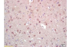 Formalin-fixed and paraffin embedded rat brain labeled with Rabbit Anti ZNF300 Polyclonal Antibody, Unconjugated (ABIN671091) at 1:200 followed by conjugation to the secondary antibody and DAB staining