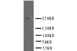 Anti-ABCA4 antibody, Western blotting WB: U87 Cell Lysate (ABCA4 antibody  (C-Term))