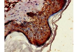 Immunohistochemistry of paraffin-embedded human skin tissue using ABIN7143911 at dilution of 1:100 (ST6GALNAC1 antibody  (AA 36-249))