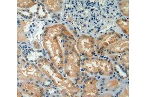 Used in DAB staining on fromalin fixed paraffin- embedded kidney tissue (TAZ antibody  (AA 154-292))