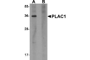 Western Blotting (WB) image for anti-Placenta-Specific 1 (PLAC1) (C-Term) antibody (ABIN1030590) (PLAC1 antibody  (C-Term))