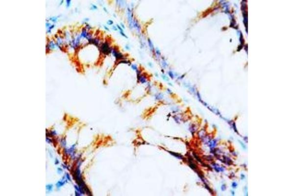 NPY1R antibody  (C-Term)