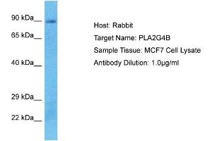 Host: Rabbit Target Name: PLA2G4B Sample Type: MCF7 Whole Cell lysates Antibody Dilution: 1. (PLA2G4B antibody  (C-Term))
