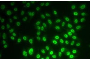 Immunofluorescence analysis of MCF-7 cells using SNRPD1 Polyclonal Antibody (SNRPD1 antibody)