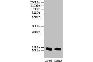 Western blot All lanes: FABP1 antibody at 16 μg/mL Lane 1: Mouse liver tissue Lane 2: Mouse small intestine tissue Secondary Goat polyclonal to rabbit IgG at 1/10000 dilution Predicted band size: 15 kDa Observed band size: 15 kDa (FABP1 antibody  (AA 1-127))
