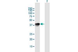 Western Blot analysis of HMX1 expression in transfected 293T cell line by HMX1 MaxPab polyclonal antibody. (HMX1 antibody  (AA 1-348))