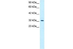 WB Suggested Anti-TAL1 Antibody Titration:  0. (TAL1 antibody  (C-Term))