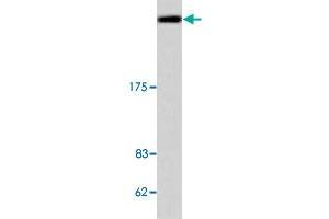 Western blot analysis of APC polyclonal antibody  in extracts from COLO 205 cells. (APC antibody)