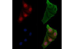 ABIN6257955 and ABIN6273780 staining Hela cells by IF/ICC. (BAG2 antibody  (C-Term))