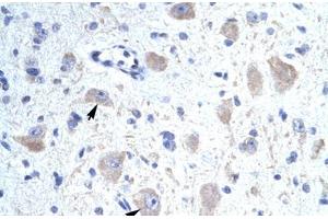Immunohistochemical staining (Formalin-fixed paraffin-embedded sections) of human brain with KCNIP1 polyclonal antibody .