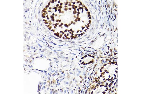 WT1 antibody