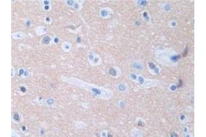 DAB staining on IHC-P; Samples: Human Cerebrum Tissue (Protein Phosphatase 3, Regulatory Subunit 1 (AA 2-170) antibody)