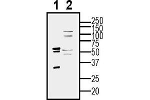 Western blot analysis of human  MG glioblastoma cell line lysate (lane 1) and  MG-derived purified exosomes (lane 2)50 μg of cells and purified exosomes lysates were analyzed using Anti-CD9 (extracellular) Antibody (ABIN7581848), (1:200). (CD9 antibody  (Extracellular))