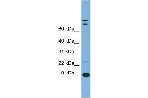 WB Suggested Anti-TFF1 Antibody Titration:  0. (TFF1 antibody  (Middle Region))