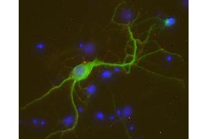 Indirect immunostaining of PFA fixed rat hippocampus neurons with anti-FBXO 41 (dilution 1 : 500; red) and mouse anti-MAP 2 (cat. (FBXO41 antibody)