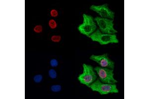 ABIN6265026 and ABIN6273161 staining Hela cells by IF/ICC.
