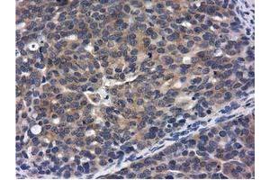 Immunohistochemical staining of paraffin-embedded Human Kidney tissue using anti-CBWD1 mouse monoclonal antibody. (CBWD1 antibody)
