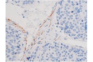 Immunohistochemistry (IHC) image for anti-Insulin Receptor Substrate 1 (IRS1) (pSer636) antibody (ABIN6255436)
