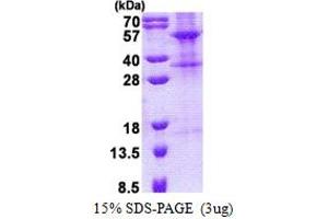 SDS-PAGE (SDS) image for Tubulointerstitial Nephritis Antigen-Like 1 (TINAGL1) (AA 22-467) protein (His tag) (ABIN5778855)