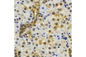 Immunohistochemical analysis of NAT13 staining in rat kidney formalin fixed paraffin embedded tissue section. (NAA50 antibody)