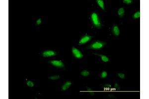 Immunofluorescence of monoclonal antibody to TSC22D4 on HeLa cell. (TSC22D4 antibody  (AA 1-395))