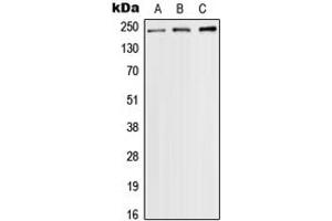 Western Blotting (WB) image for anti-Sodium Channel, Voltage-Gated, Type IX, alpha Subunit (SCN9A) (Center) antibody (ABIN7296920)