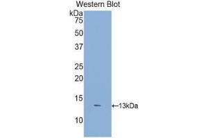 Western Blotting (WB) image for anti-Dickkopf 2 Homolog (DKK2) (AA 159-258) antibody (ABIN3207349) (DKK2 antibody  (AA 159-258))