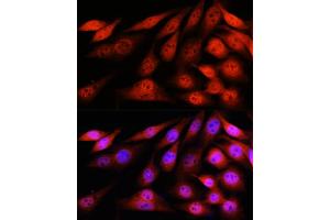Immunofluorescence analysis of NIH-3T3 cells using VCP Rabbit mAb (ABIN7271284) at dilution of 1:100 (40x lens). (VCP antibody)