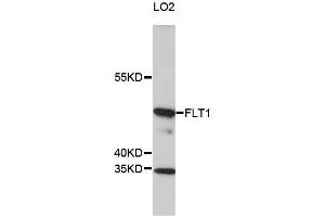 Western blot analysis of extracts of LO2 cells, using FLT1 antibody (ABIN5969988) at 1/1000 dilution. (FLT1 antibody)