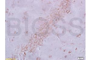 Frozen section rat brain labeled with Anti-NeuN Polyclonal Antibody, Unconjugated (ABIN732068) at 1:200 followed by conjugation to the secondary antibody and DAB staining (NeuN antibody  (AA 51-150))
