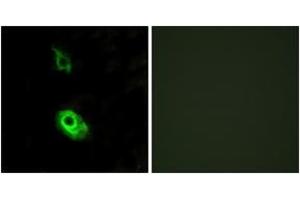 Immunofluorescence analysis of HeLa cells, using EDG3 Antibody. (S1PR3 antibody  (AA 1-50))