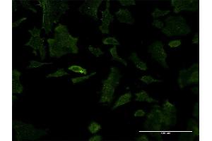 Immunofluorescence of monoclonal antibody to PSIP1 on HeLa cell. (PSIP1 antibody  (AA 1-50))