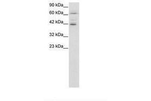 Image no. 2 for anti-Ets Variant 6 (ETV6) (AA 320-369) antibody (ABIN6735805) (ETV6 antibody  (AA 320-369))