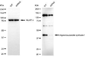 anti-Argininosuccinate Synthase 1 (ASS1) antibody