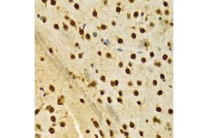 Immunohistochemistry (IHC) image for anti-Heterogeneous Nuclear Ribonucleoprotein A2/B1 (HNRNPA2B1) (AA 1-180) antibody (ABIN3021593)