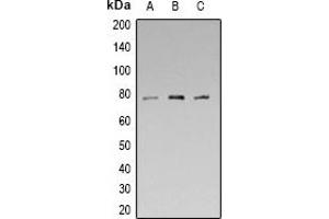 Western blot analysis of Synapsin 1 (pS553) expression in HEK293T (A), mouse brain (B), rat brain (C) whole cell lysates.