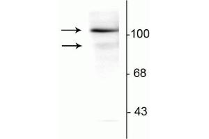 Western blot of T47D cell lysate prepared from cells that had been incubated in the presence of the synthetic progestin agonist R5020 (500 nM) showing specific immunolabeling of the ~90 kDa PR-A isoform and the ~120 kDa PR-B isoform of the progesterone receptor phosphorylated at Ser294. (Progesterone Receptor antibody  (pSer294))