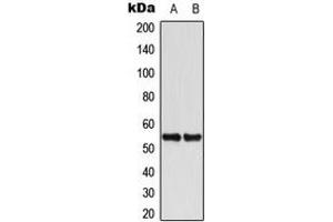 Western blot analysis of Cytokeratin 8 expression in HeLa (A), A431 (B) whole cell lysates. (KRT8 antibody  (C-Term))