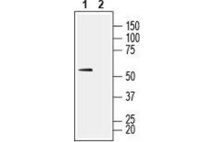 Western Blotting (WB) image for anti-Solute Carrier Family 16, Member 1 (Monocarboxylic Acid Transporter 1) (SLC16A1) (AA 403-415), (Extracellular) antibody (ABIN7043676)