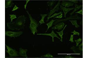 Immunofluorescence of monoclonal antibody to RPL32 on HeLa cell. (RPL32 antibody  (AA 33-132))