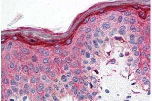 Anti-5HT1E Receptor antibody  ABIN1048261 IHC staining of human skin. (Serotonin Receptor 1E antibody  (Cytoplasmic Domain))