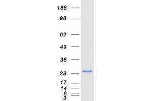 Western Blotting (WB) image for Ovarian Tumor Suppressor Candidate 2 (OVCA2) protein (Myc-DYKDDDDK Tag) (ABIN2728066)